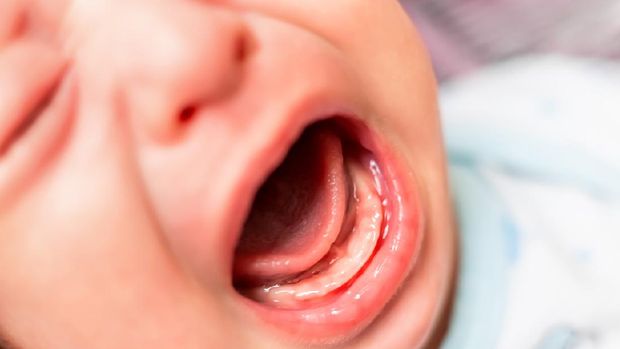 Kenali Kembar Parasit, Tak Cuma Janin Tumbuh di Otak Bayi Shanghai ilustrasi bayi